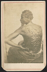 1863, Carte-de-Visite of Gordon. CDV of Louisiana slave, who escaped ...