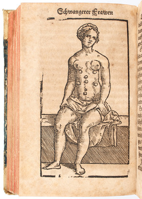 Ryff, Schwangerer Frawen Rosengarten