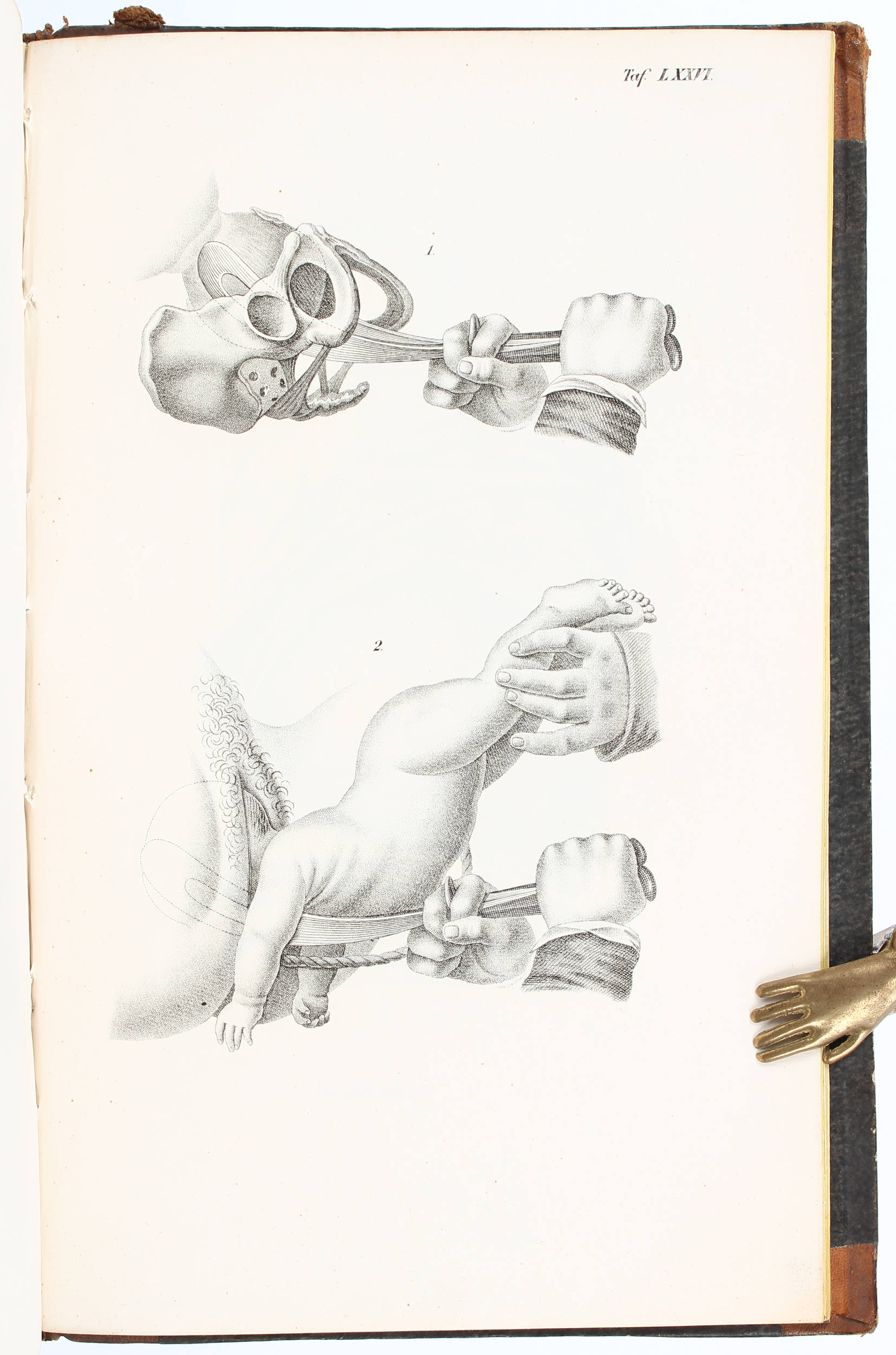 Siebold, Abbildungen der Geburtshülfe