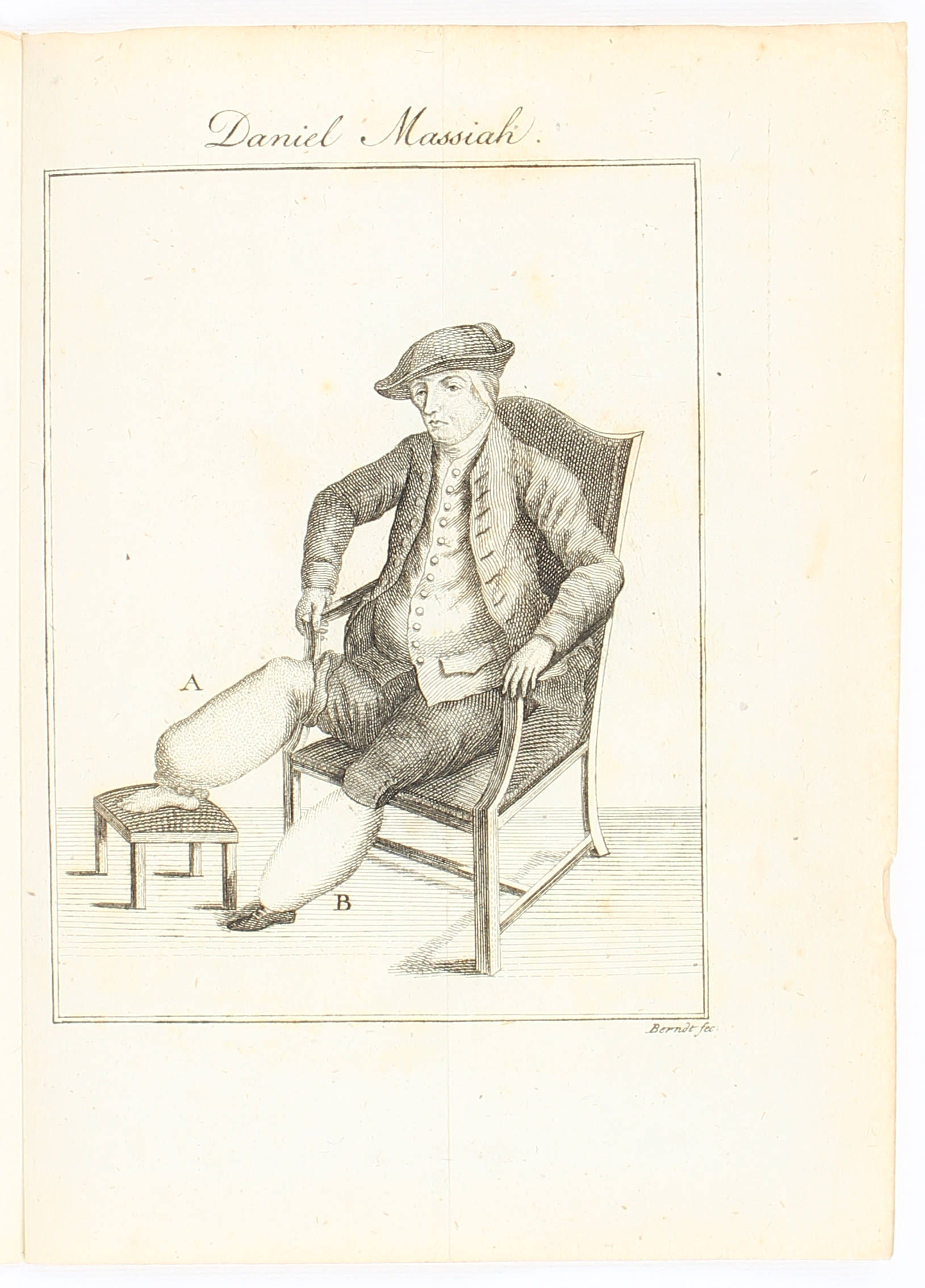 Hendy, Drüsenkrankheit in Barbados