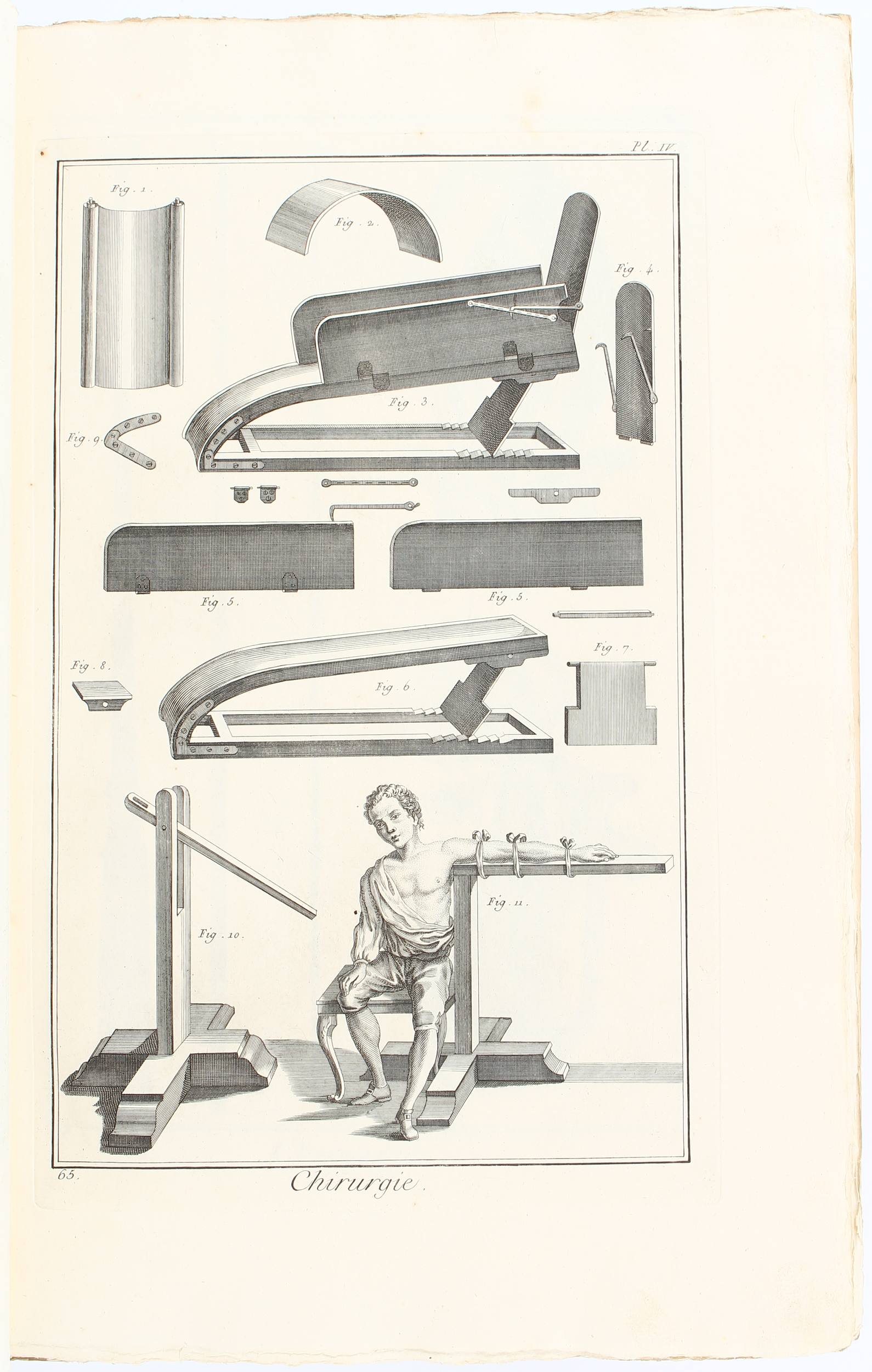 Diderot, Encyclopédie. Chirurgie