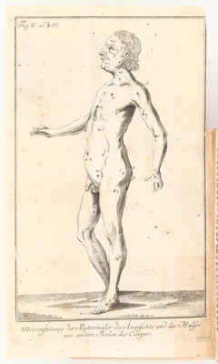 Reinhard, Satyrische Abhandlung