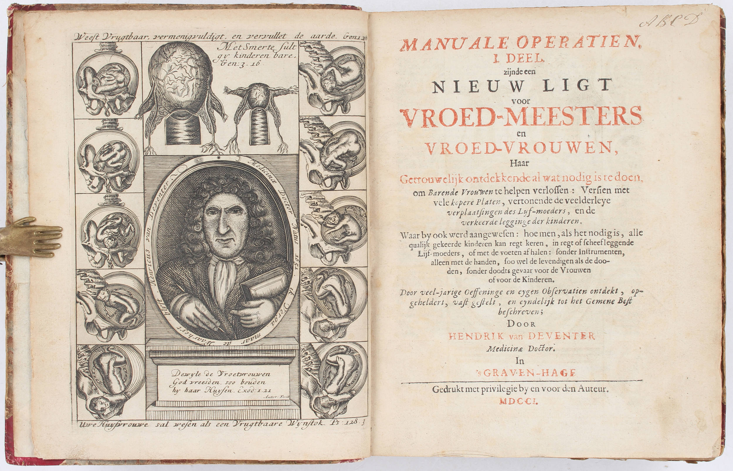 Deventer, Manuale operatien, een nieuw ligt