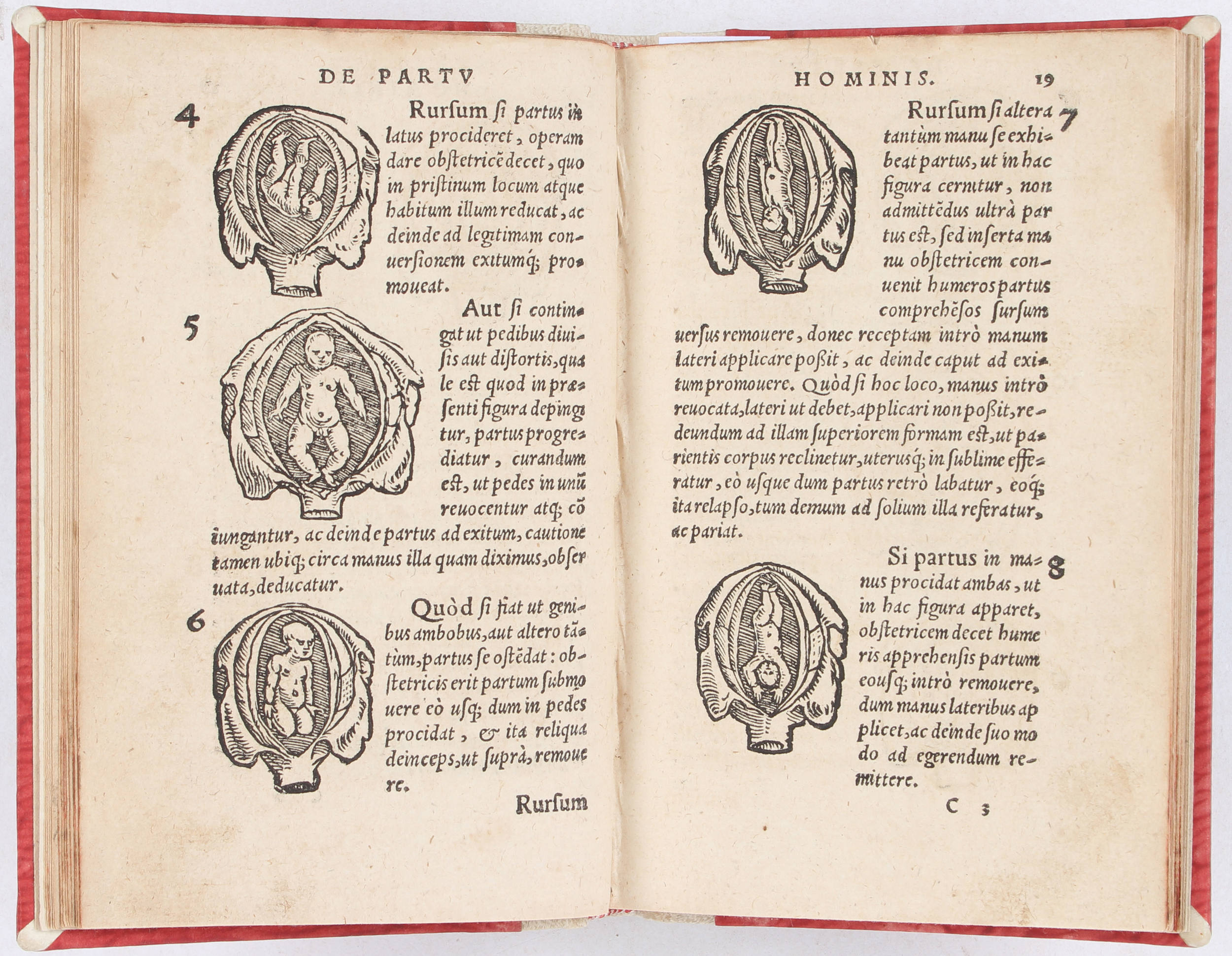 Rösslin, De partu hominis