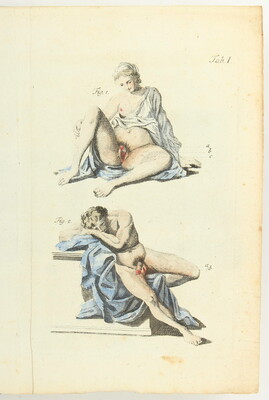 Arnaud (de Ronsil), Abhandlung über die Hermaphroditen