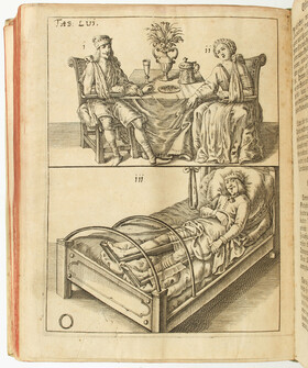 Scultetus, Wund-Artzney