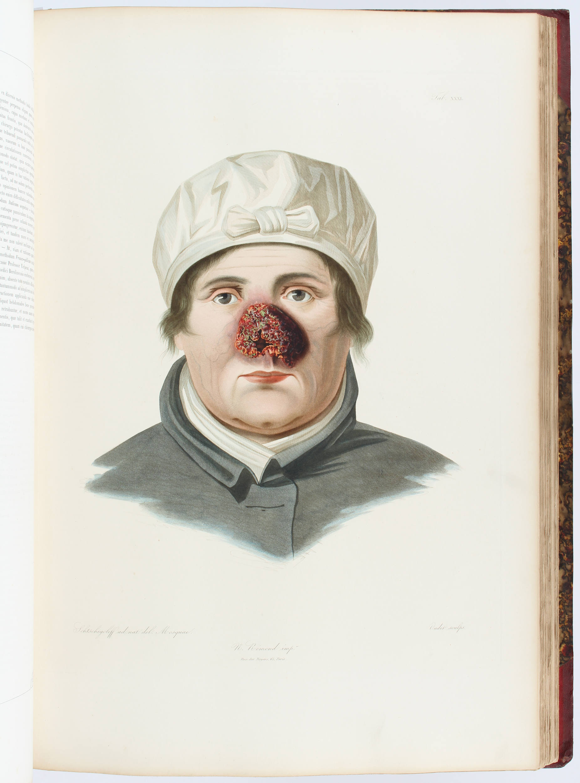 Auvert, Selecta praxis medico-chirurgicae. 2 Bde.